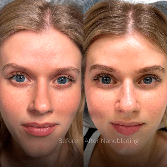 Antes-e-depois-Nanoblading-2-min.png