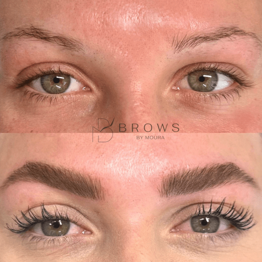 Antes-e-depois-Nanoblading-3-min.png